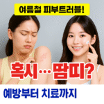 땀띠 증상부터 치료 예방까지 한번에 정리